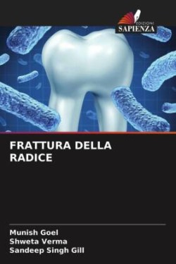 Frattura Della Radice