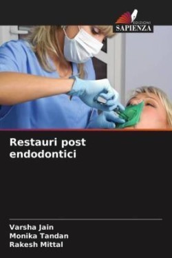 Restauri post endodontici