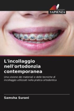 L'incollaggio nell'ortodonzia contemporanea