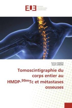 Tomoscintigraphie du corps entier au HMDP-99mTc et métastases osseuses