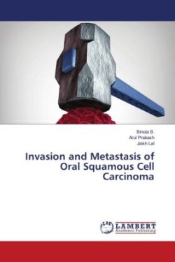 Invasion and Metastasis of Oral Squamous Cell Carcinoma