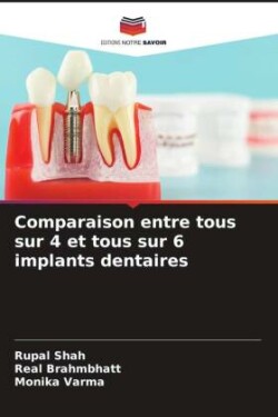 Comparaison entre tous sur 4 et tous sur 6 implants dentaires