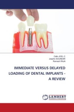 Immediate Versus Delayed Loading of Dental Implants - A Review