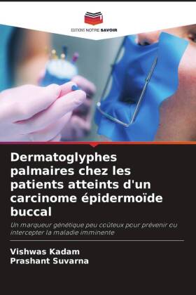 Dermatoglyphes palmaires chez les patients atteints d'un carcinome épidermoïde buccal