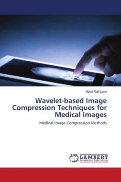 Wavelet-based Image Compression Techniques for Medical Images