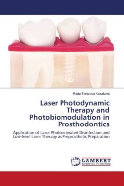Laser Photodynamic Therapy and Photobiomodulation in Prosthodontics