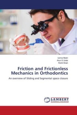 Friction and Frictionless Mechanics in Orthodontics