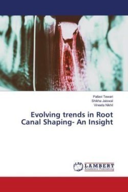 Evolving trends in Root Canal Shaping- An Insight