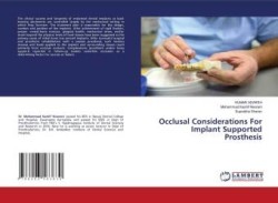 Occlusal Considerations For Implant Supported Prosthesis