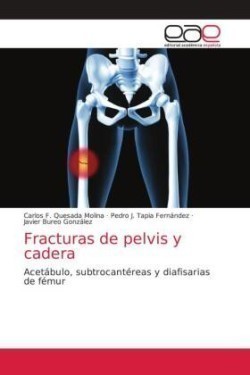 Fracturas de pelvis y cadera