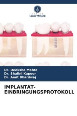 Implantat-Einbringungsprotokoll