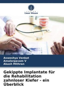 Gekippte Implantate für die Rehabilitation zahnloser Kiefer - ein Überblick