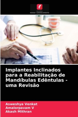 Implantes Inclinados para a Reabilitação de Mandíbulas Edêntulas - uma Revisão