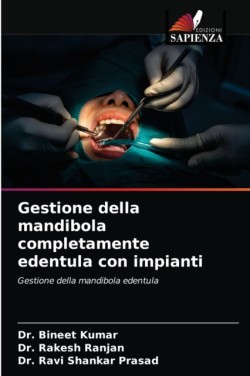 Gestione della mandibola completamente edentula con impianti