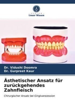 Ästhetischer Ansatz für zurückgehendes Zahnfleisch