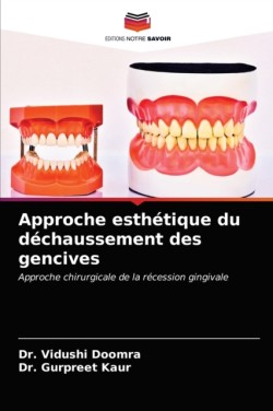 Approche esthétique du déchaussement des gencives