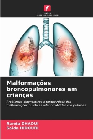 Malformações broncopulmonares em crianças