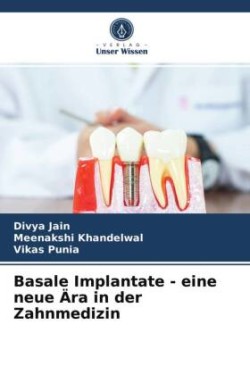 Basale Implantate - eine neue Ära in der Zahnmedizin