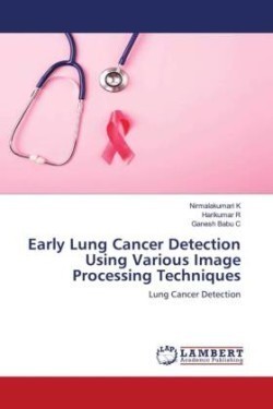 Early Lung Cancer Detection Using Various Image Processing Techniques