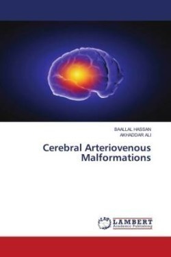 Cerebral Arteriovenous Malformations