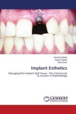 Implant Esthetics