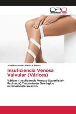 Insuficiencia Venosa Valvular (Várices)