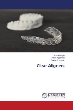 Clear Aligners