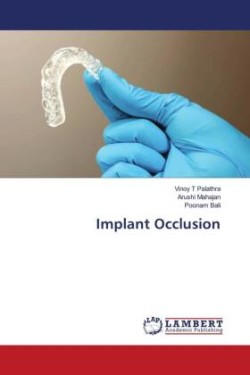 Implant Occlusion