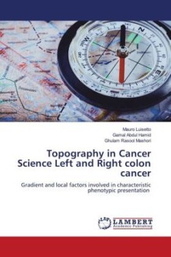 Topography in Cancer Science Left and Right colon cancer