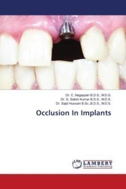 Occlusion In Implants