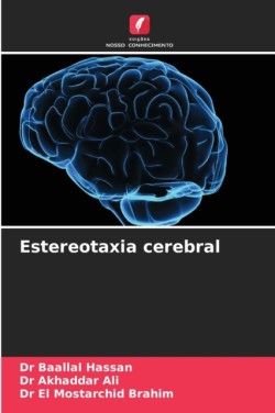 Estereotaxia cerebral