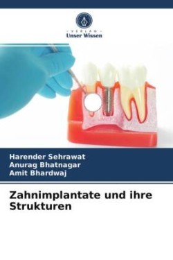 Zahnimplantate und ihre Strukturen