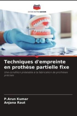 Techniques d'empreinte en prothèse partielle fixe