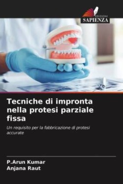 Tecniche di impronta nella protesi parziale fissa