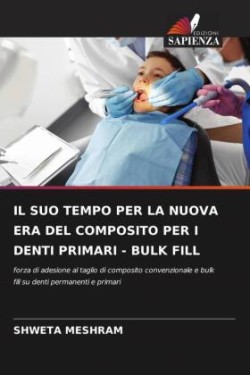 Suo Tempo Per La Nuova Era del Composito Per I Denti Primari - Bulk Fill