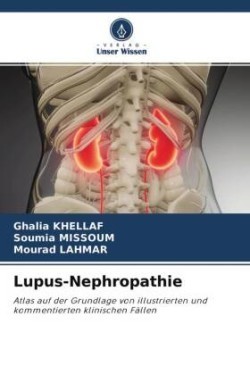 Lupus-Nephropathie