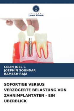 Sofortige Versus Verzögerte Belastung Von Zahnimplantaten - Ein Überblick