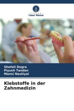 Klebstoffe in der Zahnmedizin