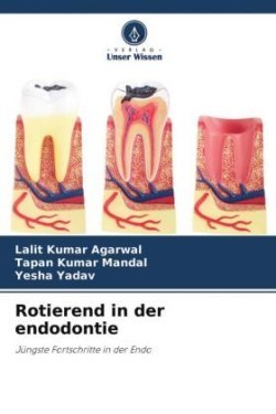 Rotierend in der endodontie