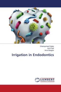 Irrigation in Endodontics