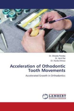 Acceleration of Othodontic Tooth Movements