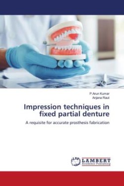 Impression techniques in fixed partial denture