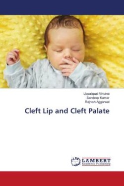 Cleft Lip and Cleft Palate