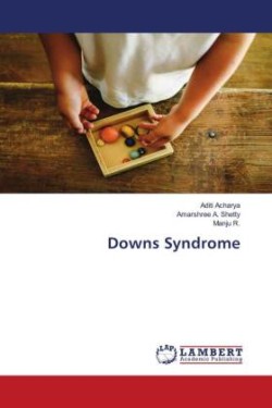 Downs Syndrome