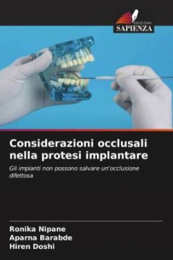 Considerazioni occlusali nella protesi implantare