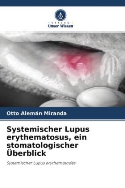 Systemischer Lupus erythematosus, ein stomatologischer Überblick