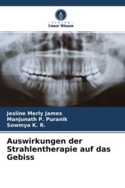 Auswirkungen der Strahlentherapie auf das Gebiss