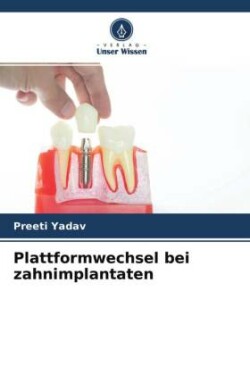 Plattformwechsel bei zahnimplantaten