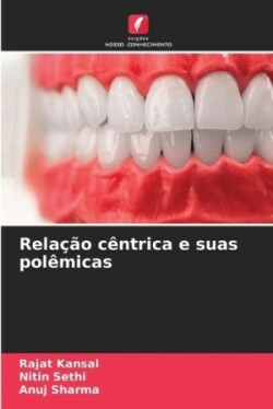 Relação cêntrica e suas polêmicas