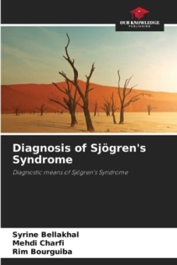 Diagnosis of Sjögren's Syndrome